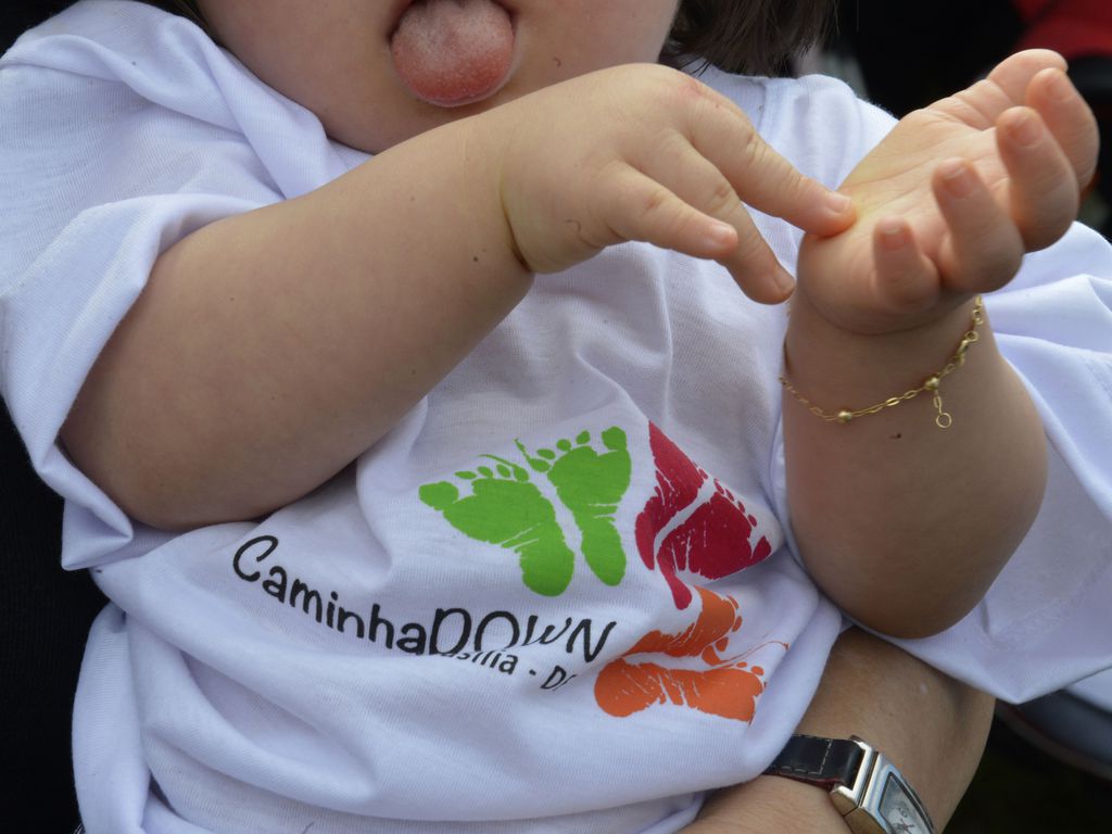 SUS: governo cria decreto para diagnóstico neonatal de síndrome de Down