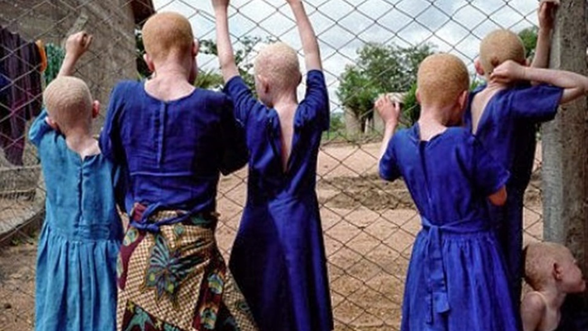 Em Namialo, na província de Nampula, a polícia deteve indivíduos, dos quais dois professores, em conexão com o trafico de albinos.